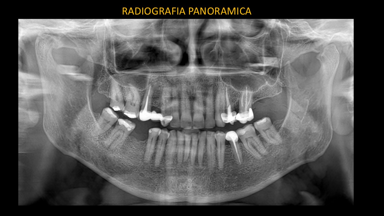Figura 1: Radiografía Panorámica